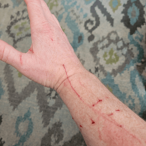 Cut hand from feral cat